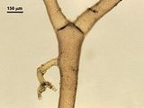 4 – Rizoide con apice digitato che emerge dalla zona  mediana di una cellula assiale